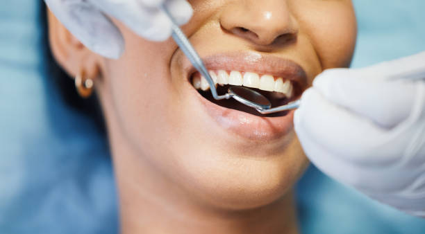 Best Emergency Tooth Extraction in Oberlin, OH